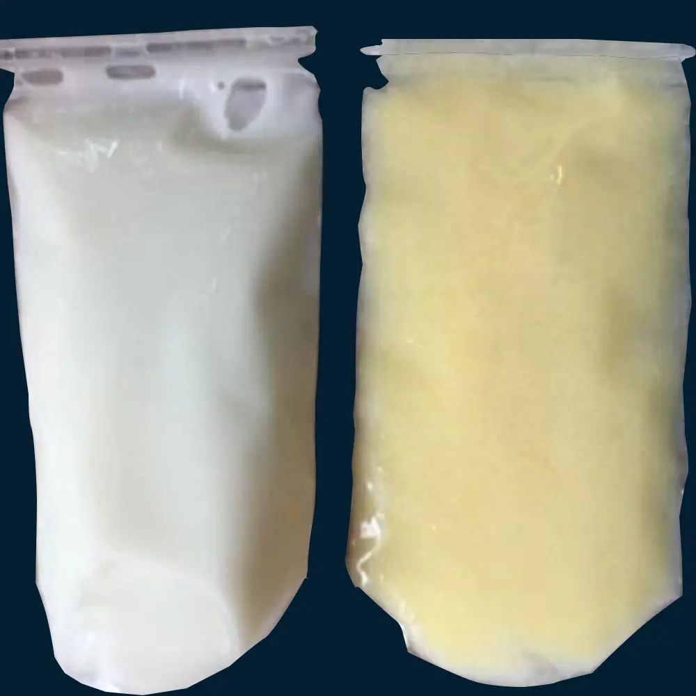 Normal milk vs milk when you