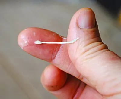 Clogged Milk Duct Coming Out