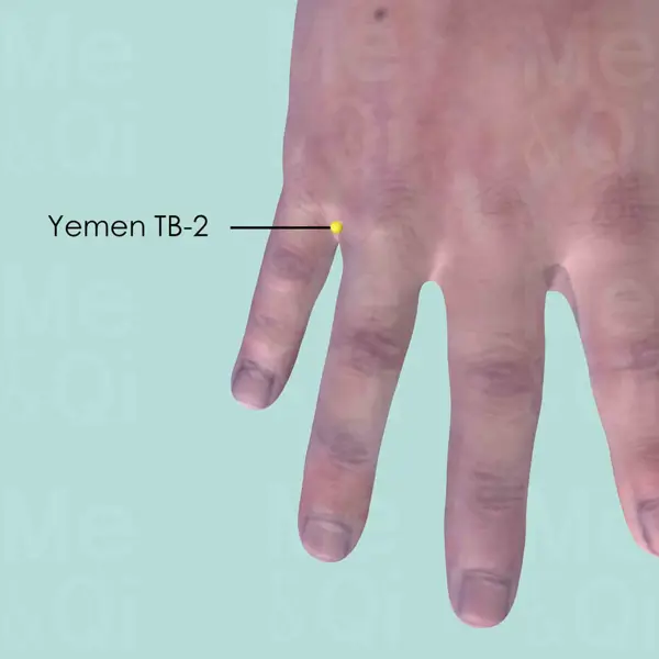 Yemen SJ-2 location