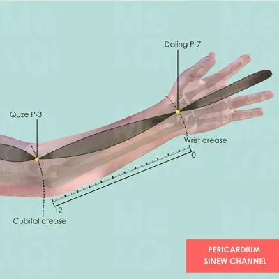 Pericardium Sinew Channel pathway