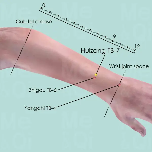 Huizong ST-7 location