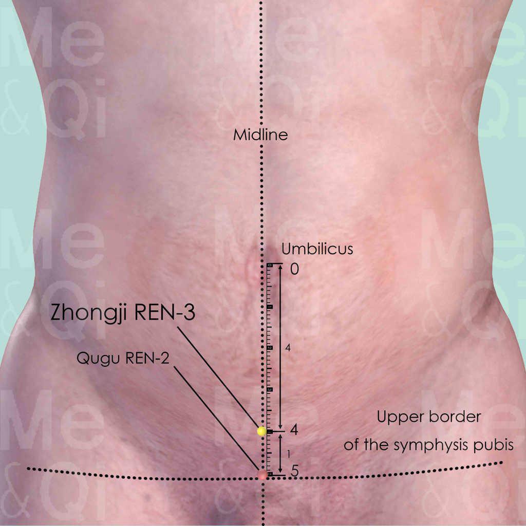 Zhongji REN-3 location